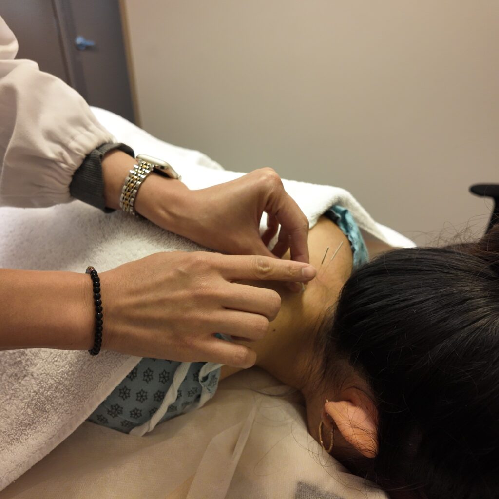 Vancouver Acupuncturist, Burnaby Acupuncturists are working at Healing Sense Clinic in Burnaby, Vancouver, North Vancouver, Coquitlam, Surrey, New Westminster, and Richmond.