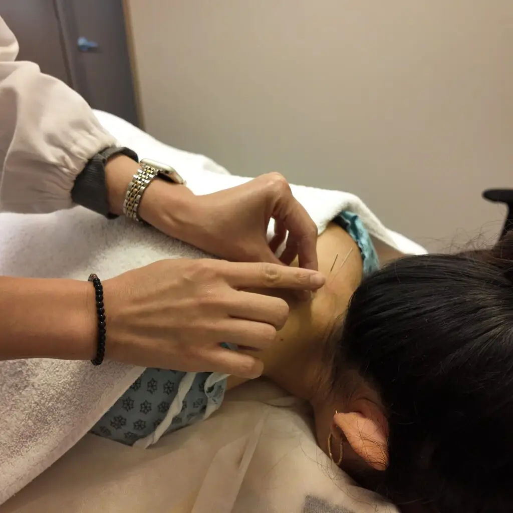 Burnaby Acupuncturist at Healing Sense Clinic in Burnaby North.